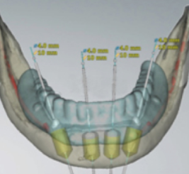 1456551712593564.png 导板模拟图片.png